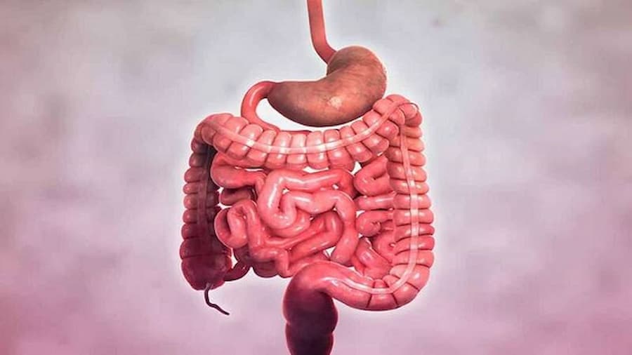 Bệnh Crohn là gì? Nguyên nhân, triệu chứng và cách điều trị