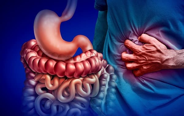 Nguyên nhân dẫn đến bệnh Crohn là gì?